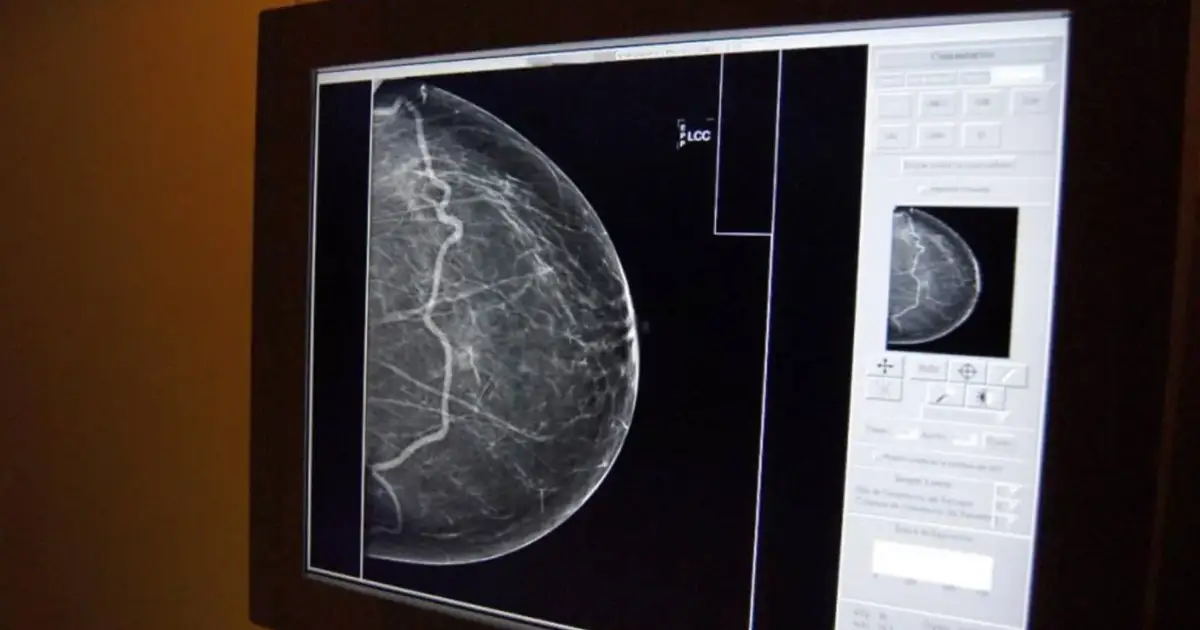 Novo centro de rastreio do cancro da mama em Lisboa vai abranger mais 10 mil mulheres por ano