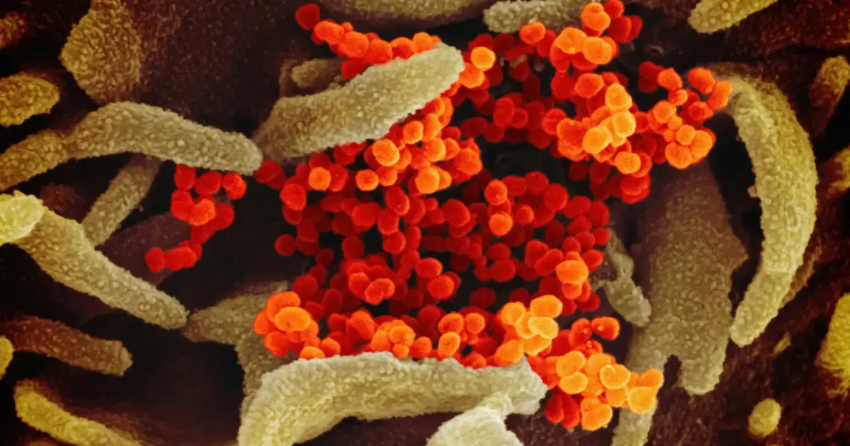 Prémio Bial distingue estudo sobre papel do microbioma no tratamento do cancro